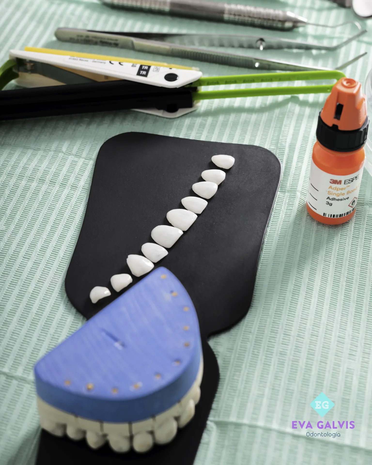 We fabricate veneers and prosthetics in our own laboratory